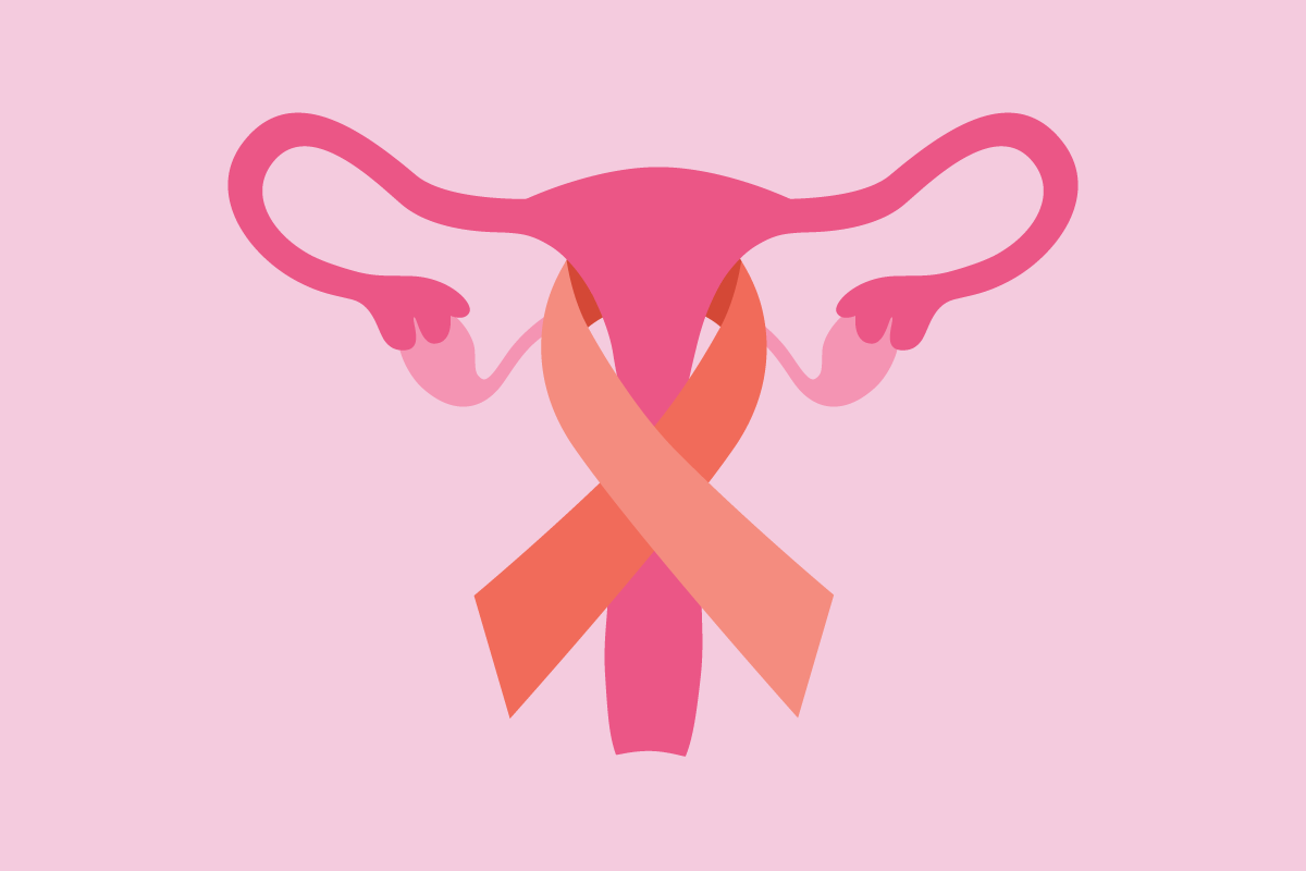 Endometrial Cancer Testing and Diagnosis