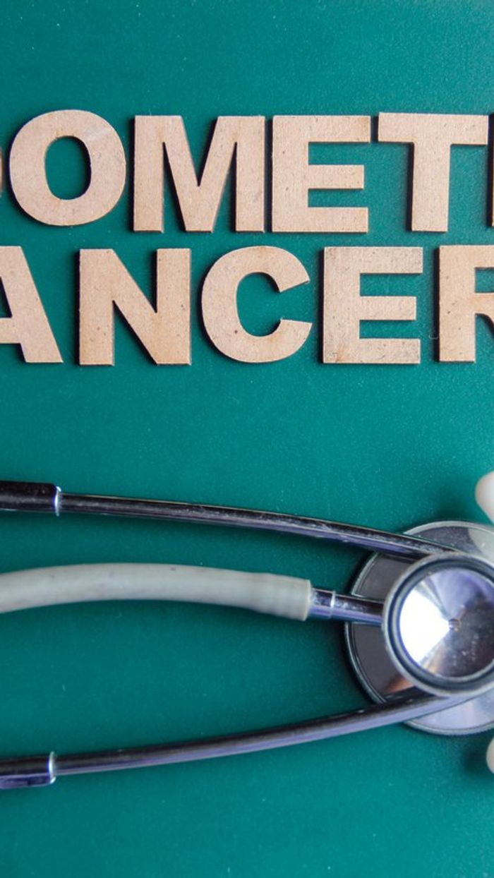 Preguntas frecuentes relacionadas con el cáncer endometrial